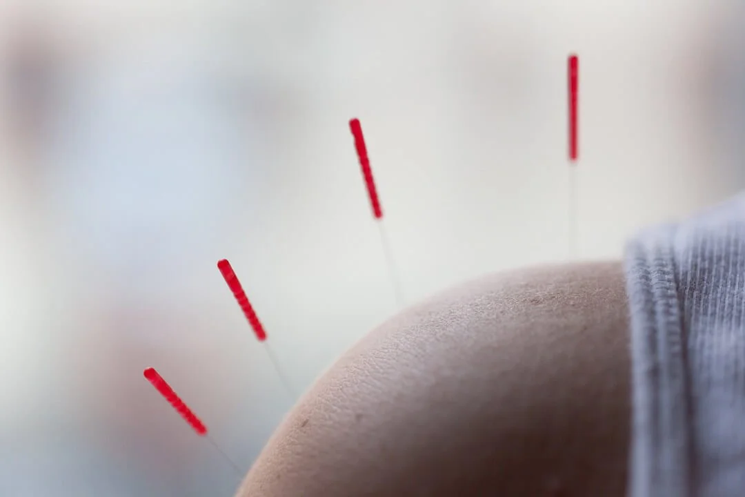 Acupuncture Meridians: How They Work and Why They Matter