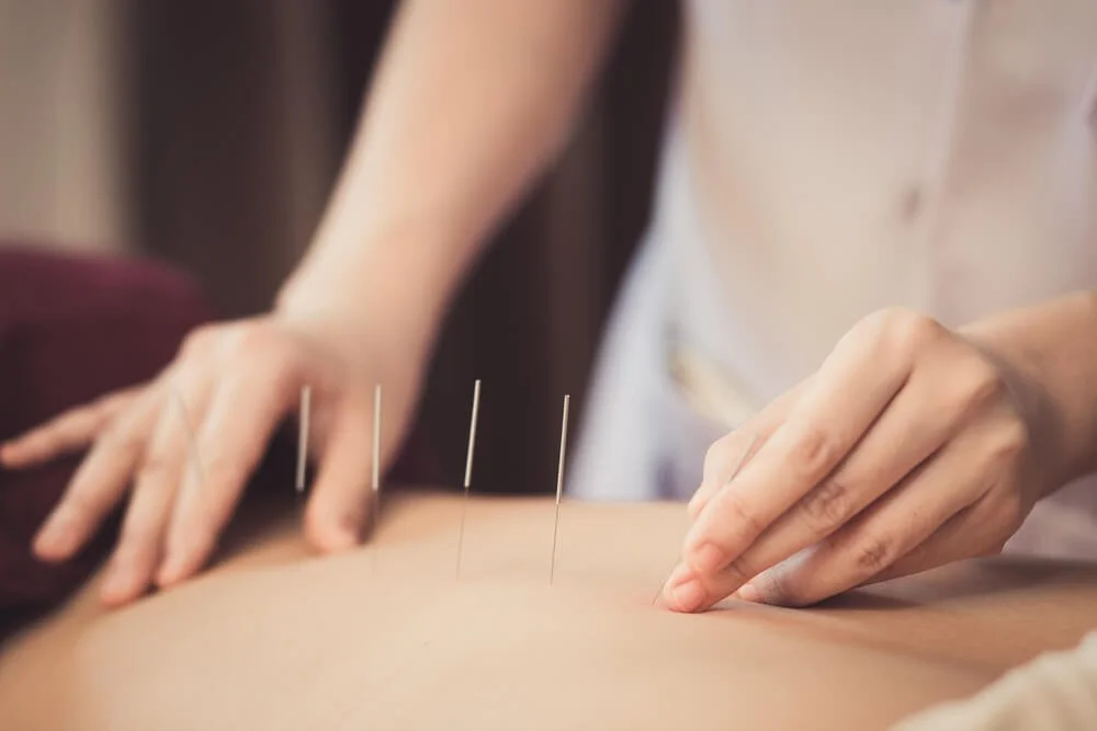 Electroacupuncture Benefits for Pain Relief, Recovery, and Wellness
