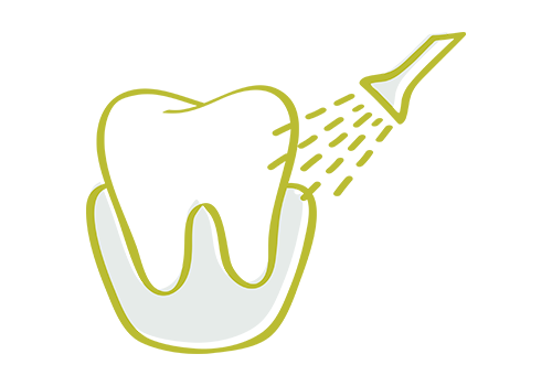 Dental Cleanings