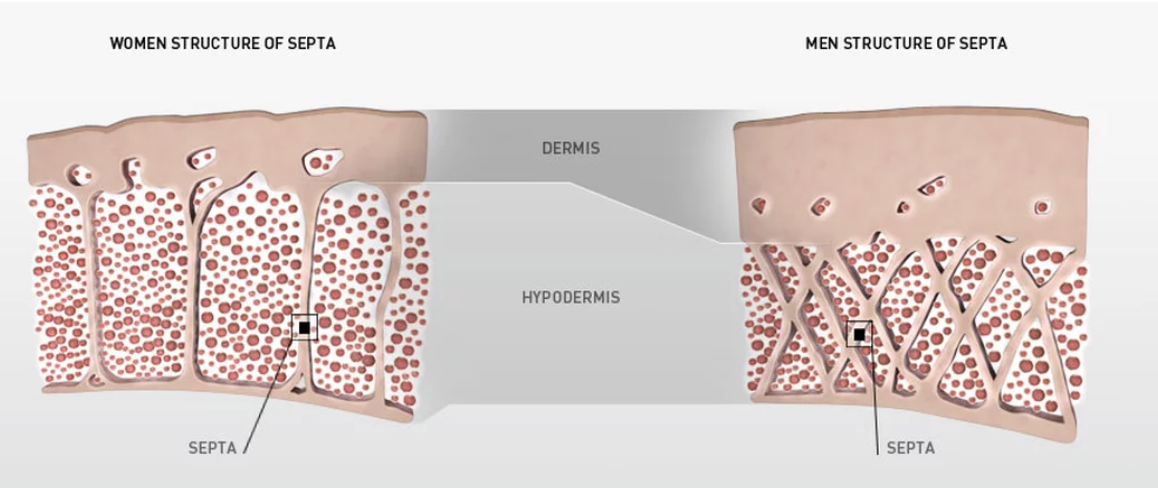 Cellulite....here's the lowdown