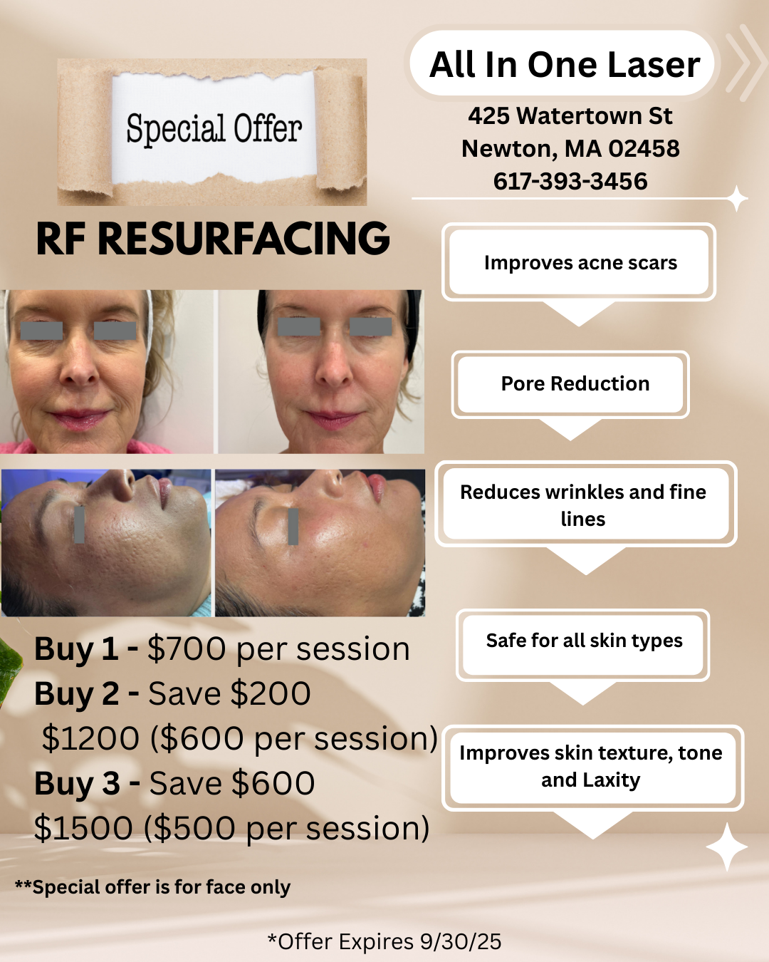 resurfacing, wrinkles, acne scars