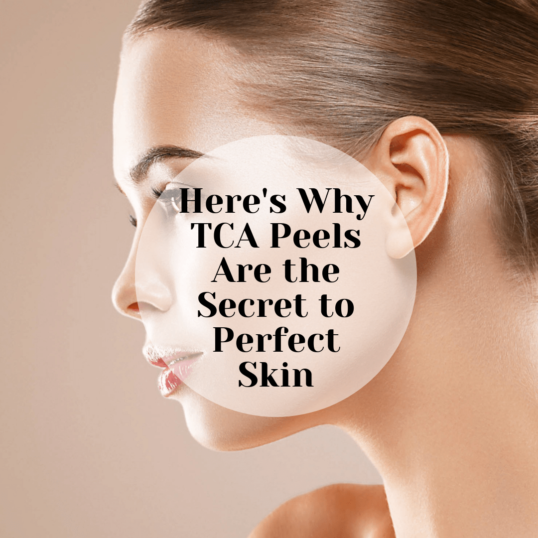 Skin: TCA Peels Pre and Post Care and what to expect:
