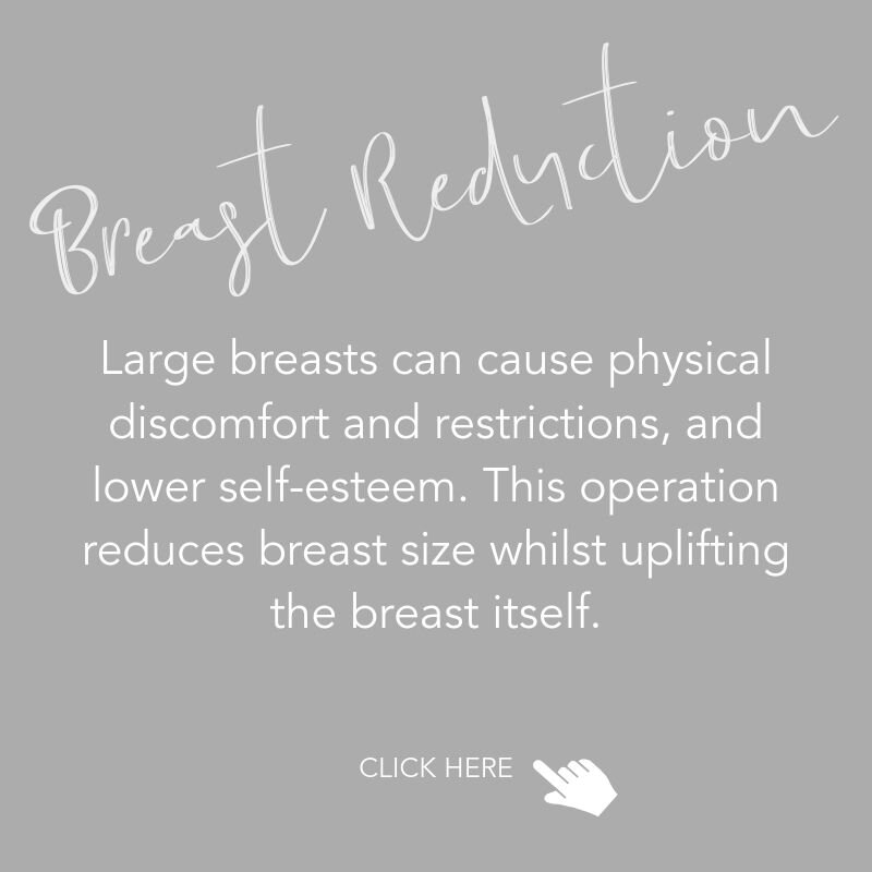 Breast Reduction (Copy)