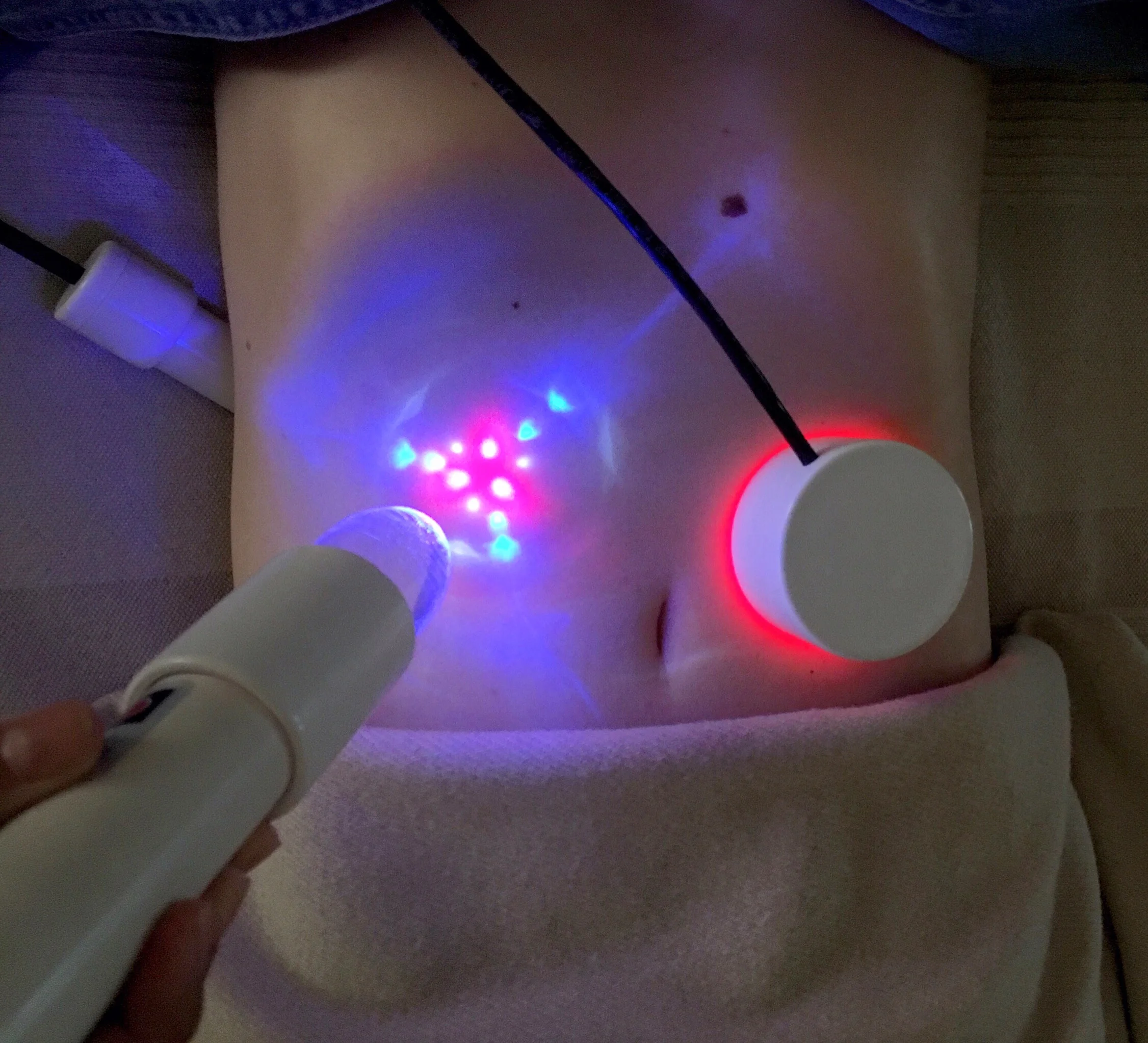 torsolymph light.JPG