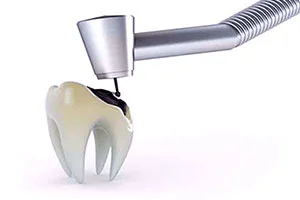 endodontics_1_14.jpg
