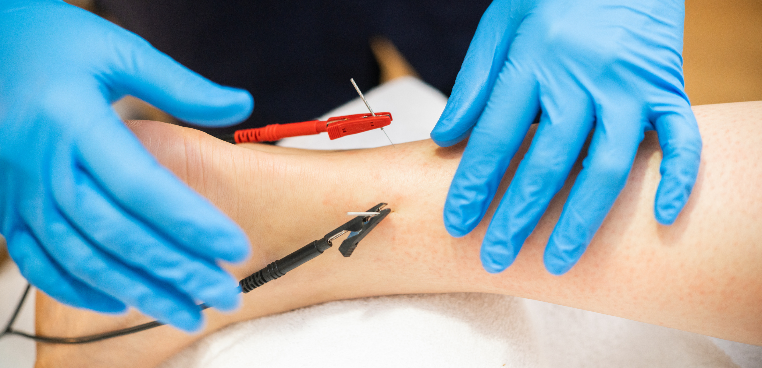 electrotherapy (1).png
