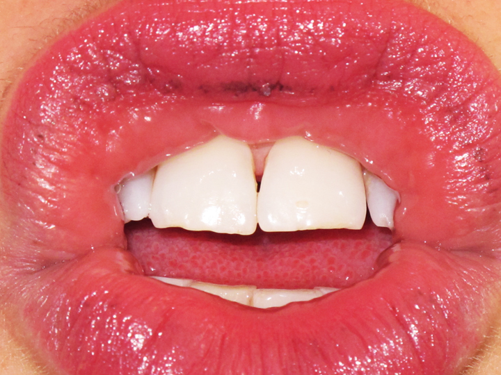   Untitled (Self-Portrait, Lips) 2007  