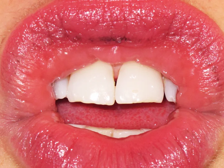Untitled (Self-Portrait, Lips) 2007