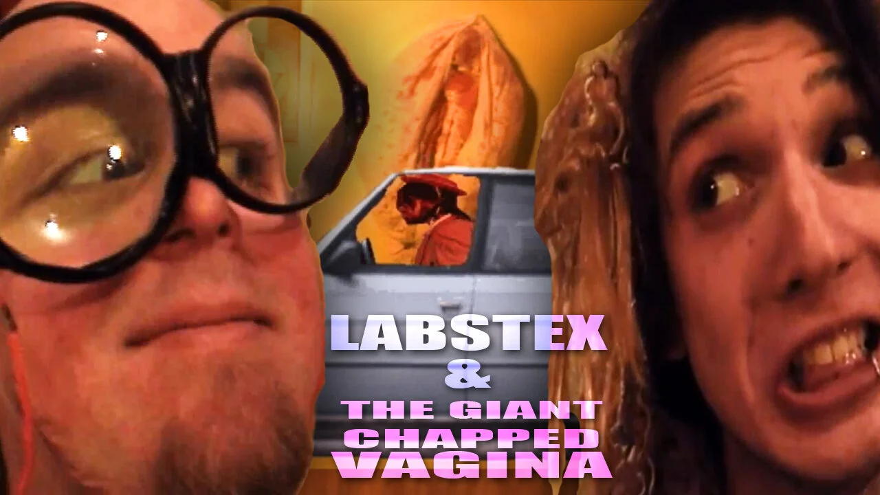 chapped.jpg