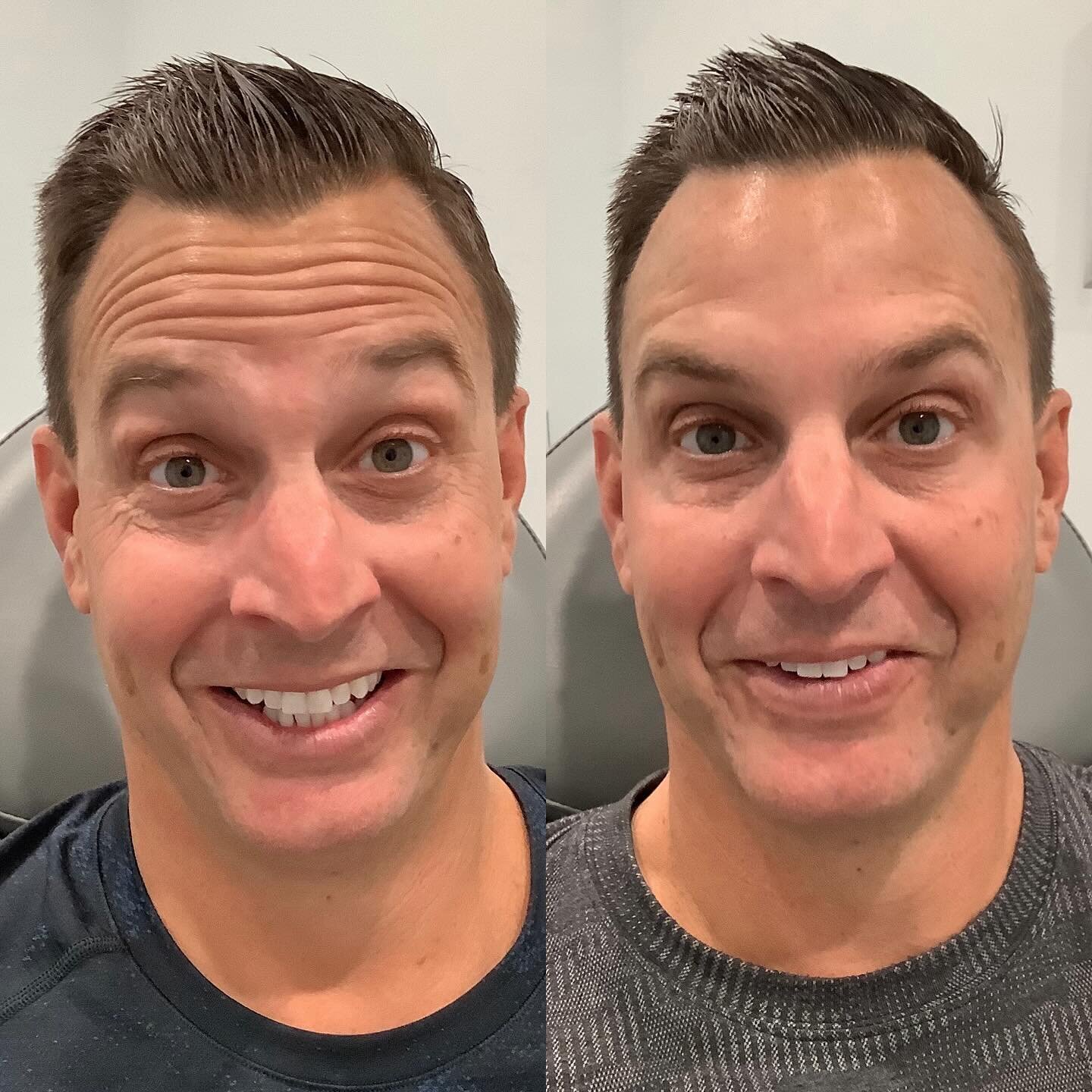 💕💕Ladies!! Looking for a gift for your Valentine?  Men love Botox and Dysport too (even though they may not say it😜)💕💕 Bring your man in for his first treatment and he receives $50 off and you receive $25 your next treatment!! Good thru February