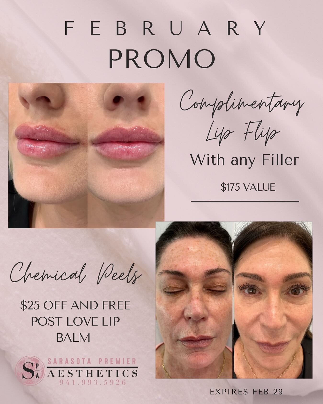 💋❤️Call today to take advantage of these February specials just in time for Valentine&rsquo;s Day💋❤️ Link in bio to book!

#botoxsarasota #botoxlakewoodranch
#lipfillerlakewoodranch #sarasotabotox
#lakewoodranchmedspa #lakewoodranchbotox #masterinj