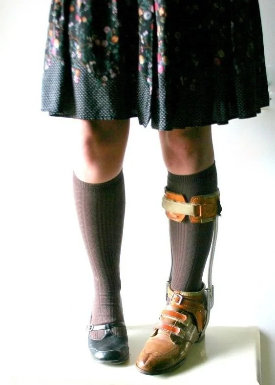 May's Leg Brace