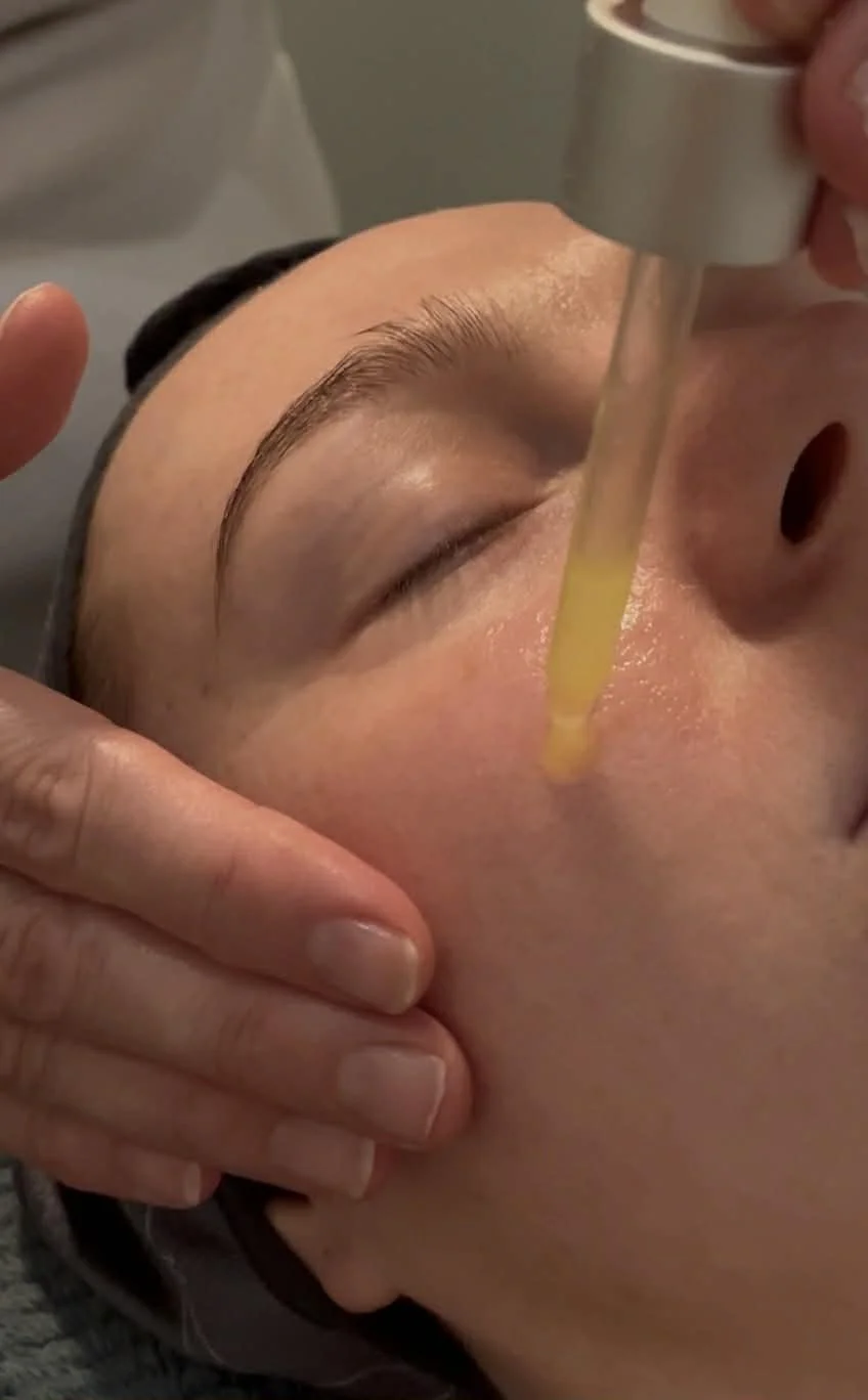 Microneedling Albury.jpg