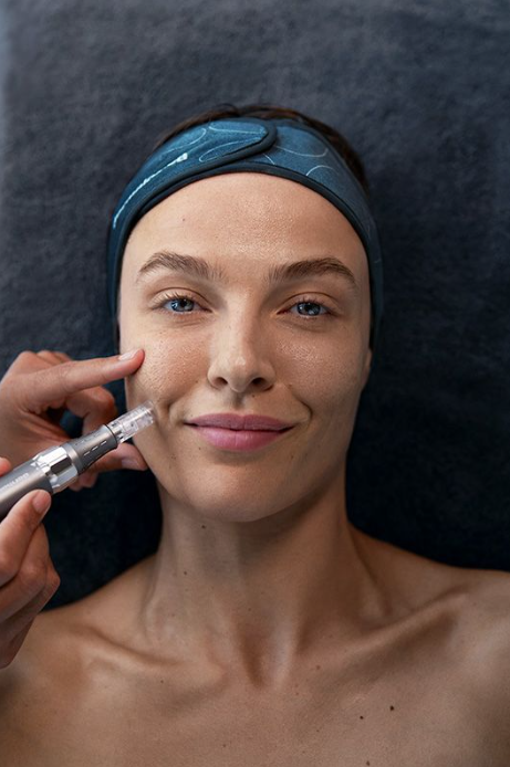 MICRO NEEDLING ALBURY.png