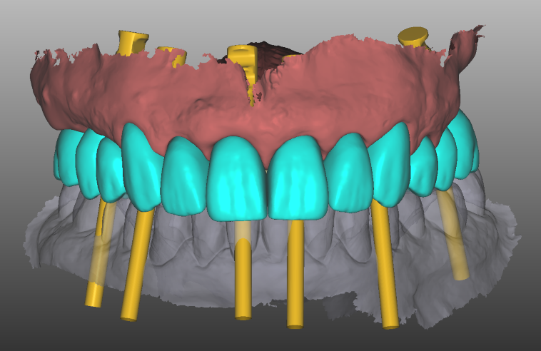 full arch planning.png
