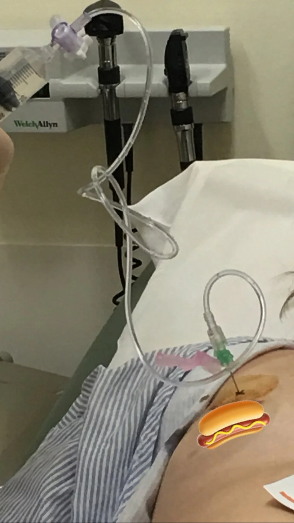 During the expansion process, the nurses find my metal expander port with a magnet, then inject a needle through my skin to gradually inflate the expanders with fluid