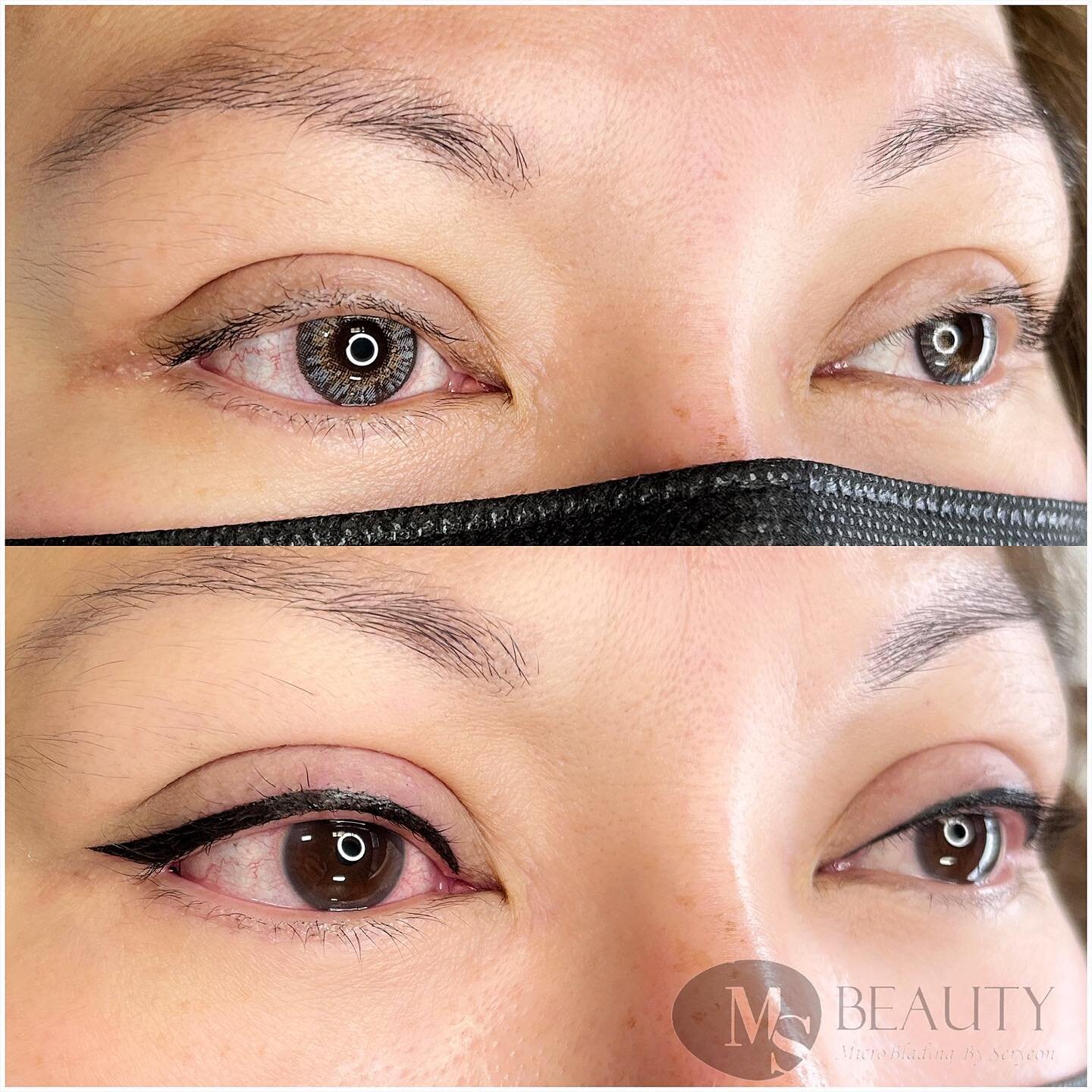 Eyeliner tattoo
Immediately  after
.
.

𝐌𝐬&nbsp;𝐛𝐞𝐚𝐮𝐭𝐲
⠀
▪️Introduced and published in reliable and recognized media oulets in Korea (VJ특공대,&nbsp;무한지대&nbsp;큐등&nbsp;다수의&nbsp;언론.잡지에&nbsp;소개됨) 
▪️Acquired Cosmetology 