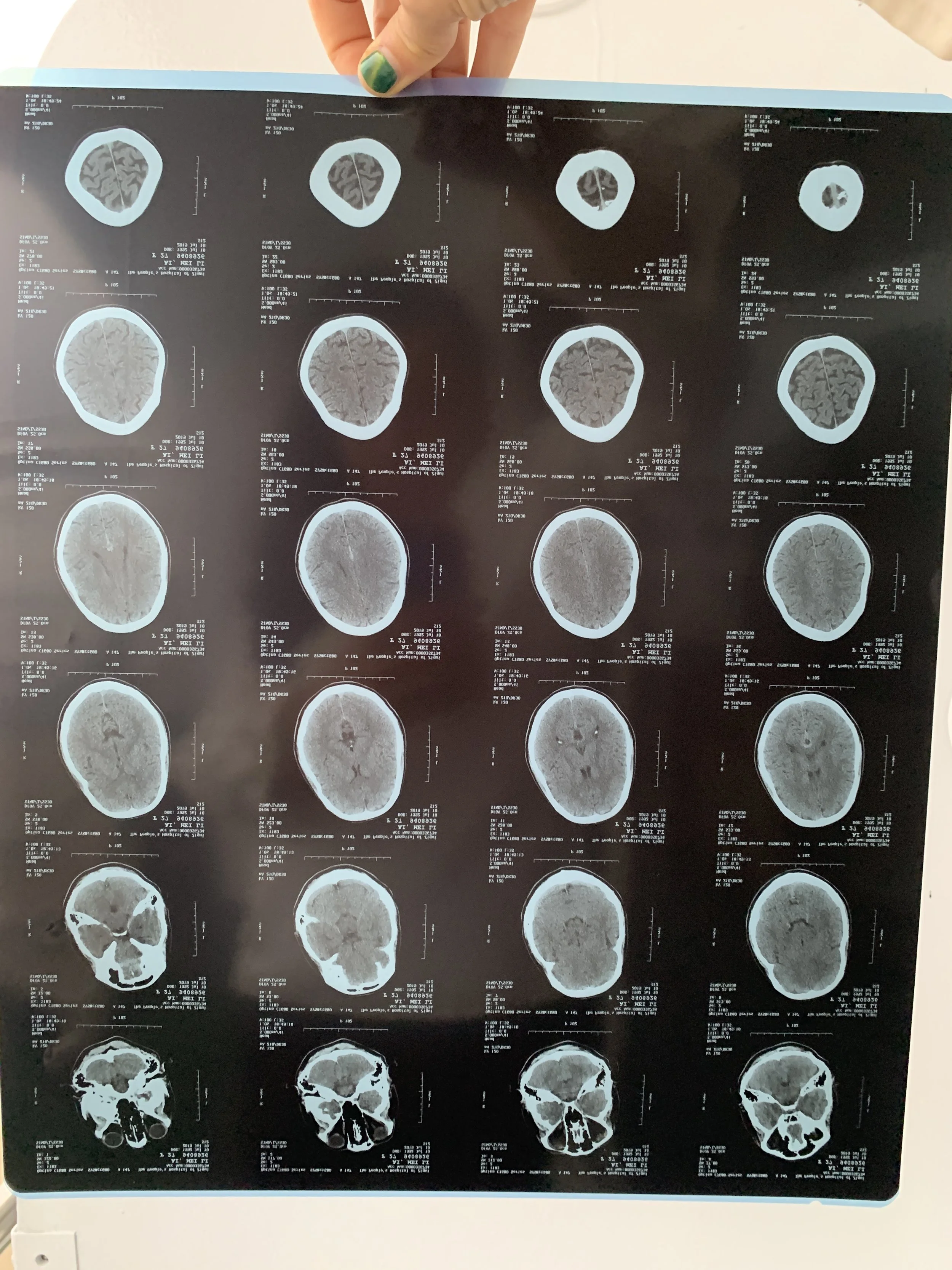 When you're vehemently living