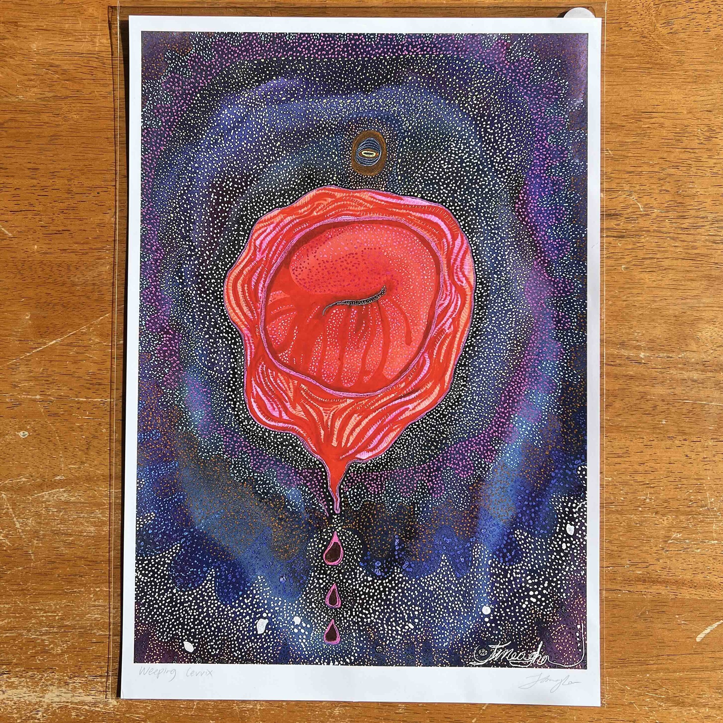 weeping_cervix_oversized_poster_paper_print.jpeg