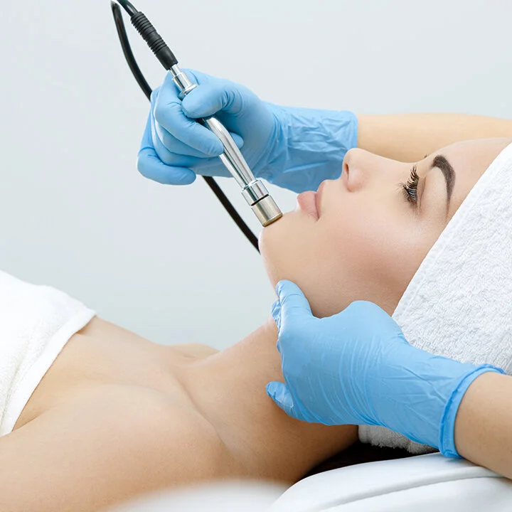 Microdermabrasion
