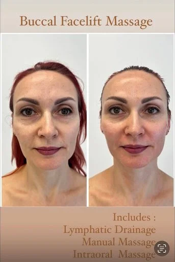 advanced buccal 5.jpg
