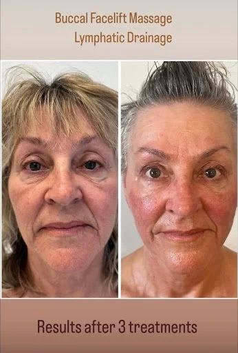 advanced buccal 6.jpg
