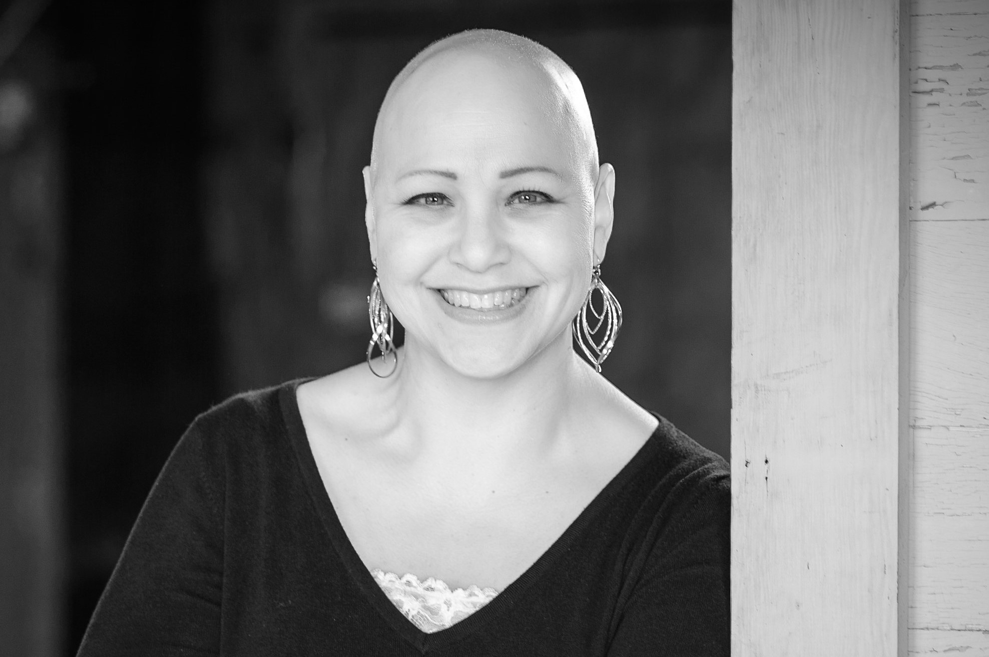 Ep 004: Alopecia and Insomnia-- with Deeann Graham