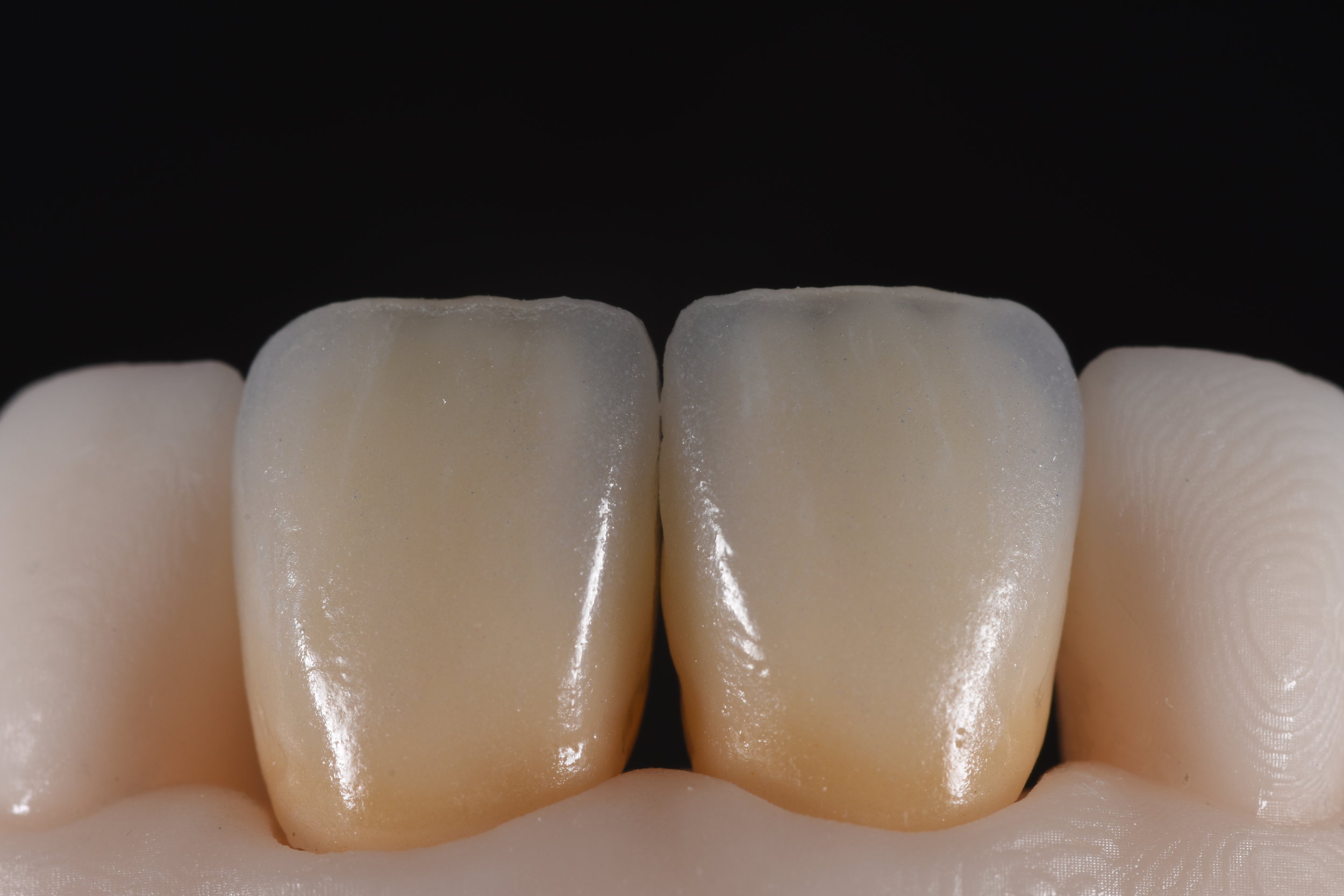 Ceramics — Queensway Dental Laboratory