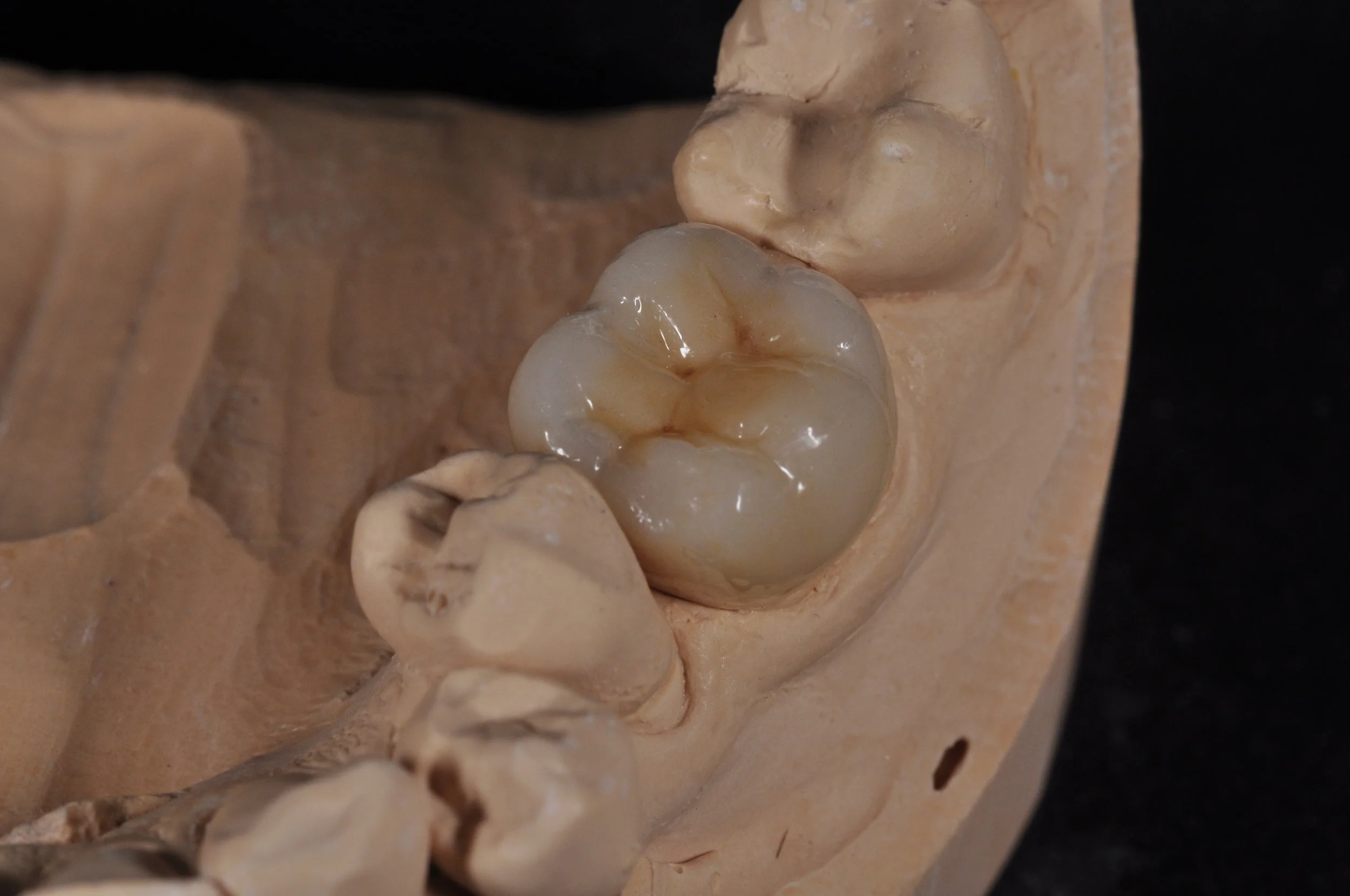 Ceramics — Queensway Dental Laboratory