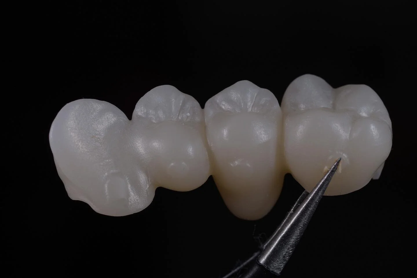🔶So we&rsquo;re back! 🔶
It&rsquo;s been a very busy and challenging start. 🔷Getting back into routine and use to the new normal but slowly get back into swing of things! 🔷
🔶Here&rsquo;s a &lsquo; facing&rsquo; only zirconia bridge, look at the l