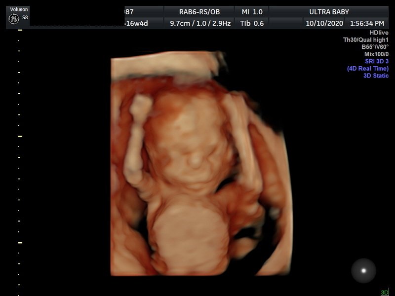 3D/4D Ultrasound Packages & Pricing |