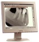 xray.gif