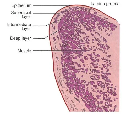 The structure of the vocal fold. From Sataloff, R.T., Chowdhury, F., Portnoy, J., Hawkshaw, M.J., Joglekar S. Surgical Techniques in Otolaryngology – Head and Neck Surgery: Laryngeal Surgery. New Delhi, India: Jaypee Brothers Medical Publishers; 2013 with permission.