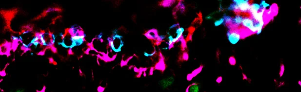 061716_vimentin dapi_NeuN 488_IBA1 Cy3_GFAP 647_20x_lvl26 copy.jpg