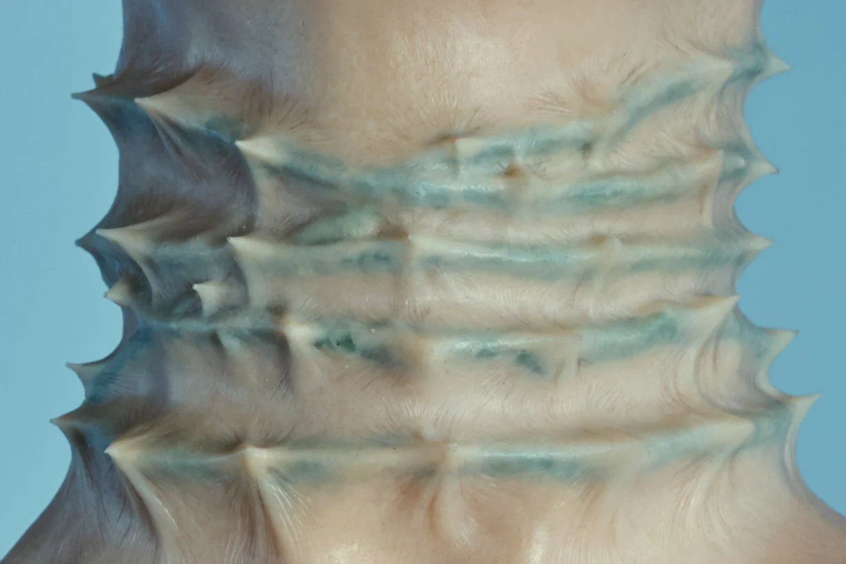 sore-throuat-close-up.jpg