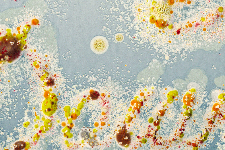 Petri_Dish_RT1_close_up.jpg