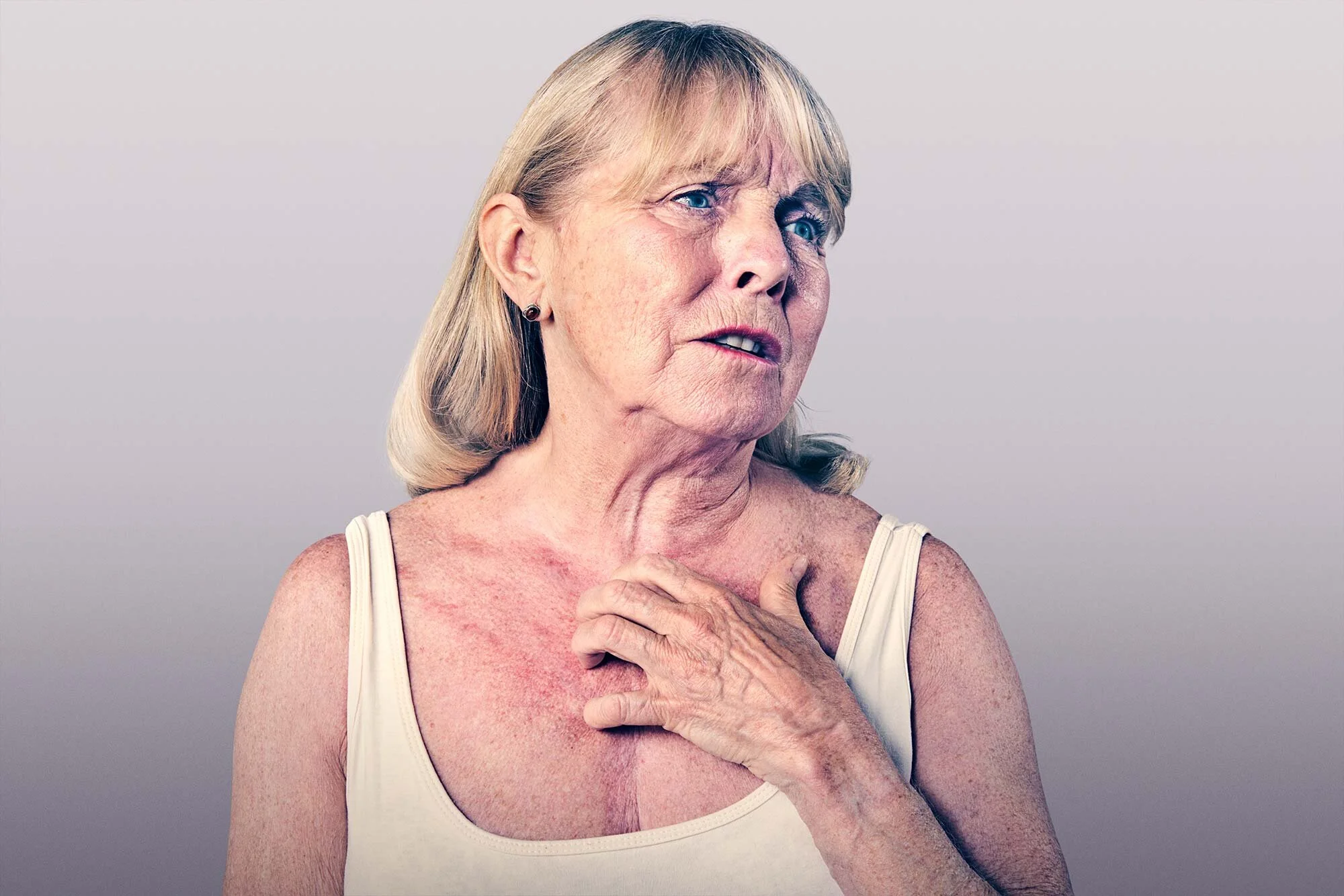 An older woman with blonde hair, wearing a white tank top, appears distressed, with her hand on her chest and a look of concern or discomfort on her face. She has red skin and visible skin damage.