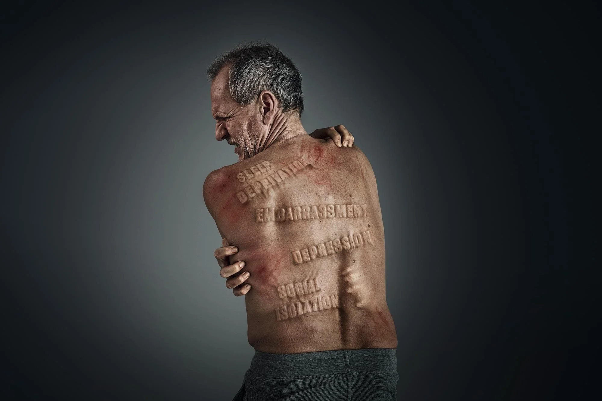 An older man with gray hair and a beard appears to be in pain, clutching his shoulder. His back is covered with words and phrases carved into his skin, including 'Super Detachment,' 'En Barrassment,' 'Depression,' 'Social Isolation,' and other distre