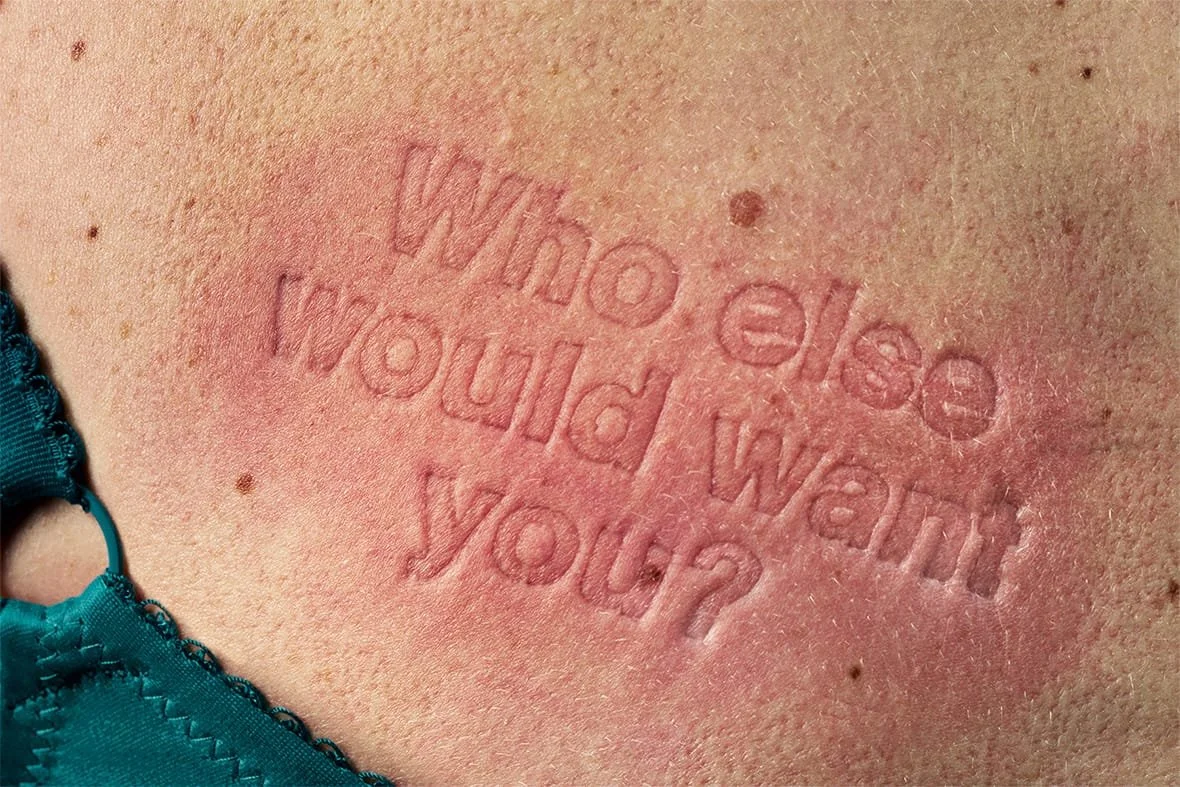 Close-up of a person's skin with a pinkish imprint of text that reads, 'Who lost your mind?'. Part of a teal-colored item is visible in the lower left corner.