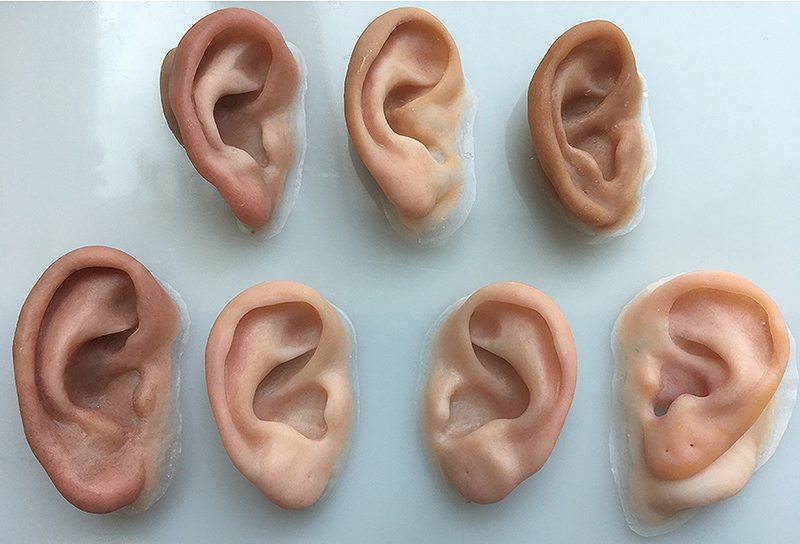 Custom-made prosthetic ears for Microtia Clinic