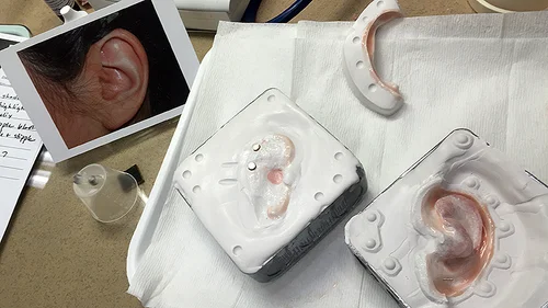 Prosthetic Ear - Ear Prosthesis - Microtia | Wisconsin — Life-like ...