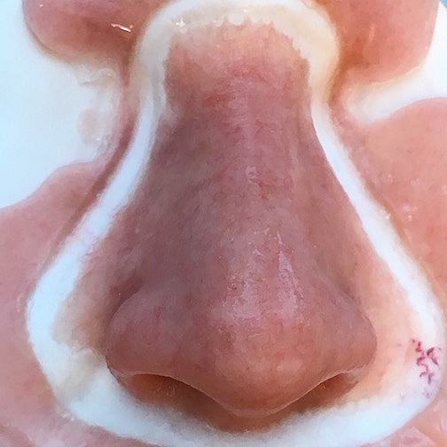 Color detail in a silicone nasal prosthesis just out of the mold 