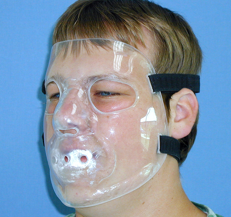 Custom Athletic Faceguards - Medical Art Resources — Life-like