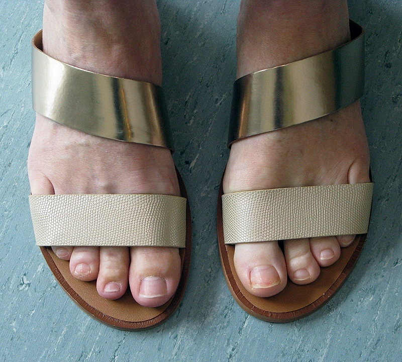 Careful shoe selection helps with comfort and appearance of toe prostheses