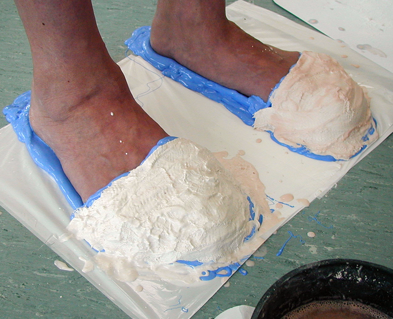 Making molds for a great toe prosthesis