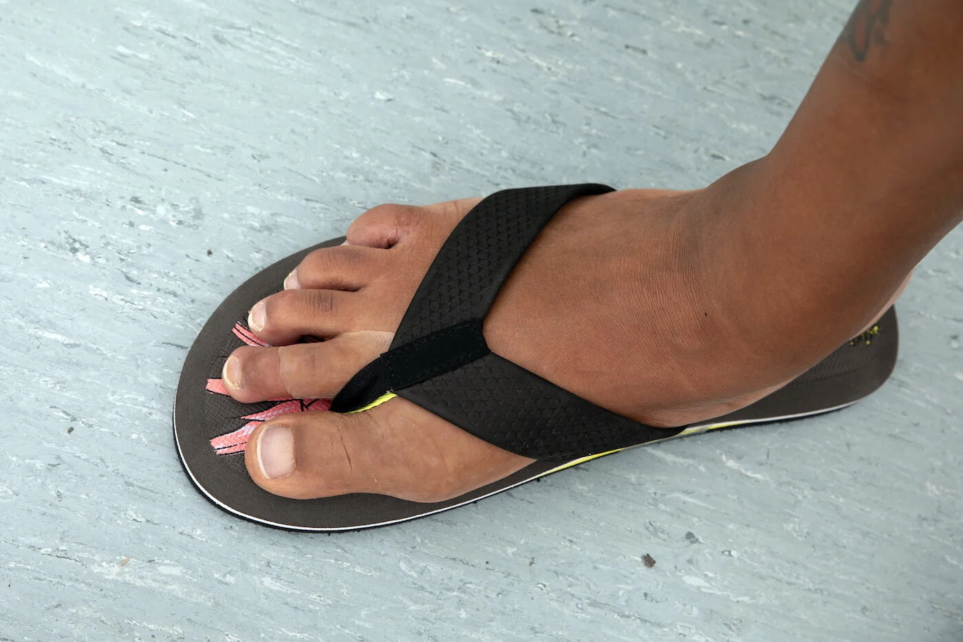 Toe Prosthesis Milwaukee — Lifelike Prosthetics