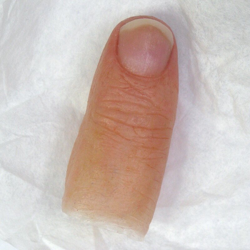 Custom silicone fingertip prosthesis 