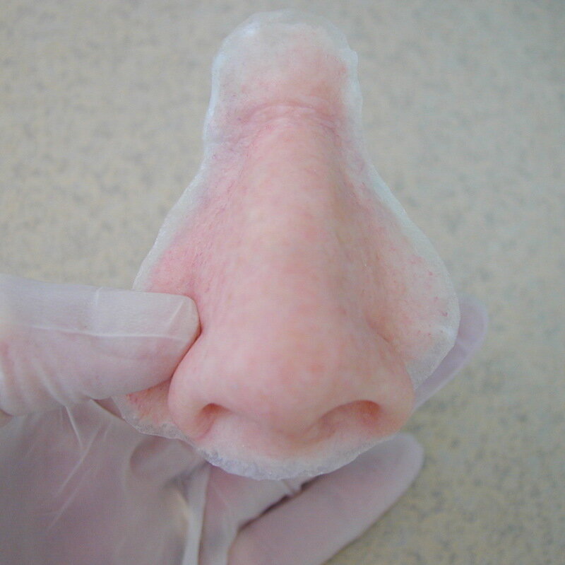 Custom silicone prosthetic nose