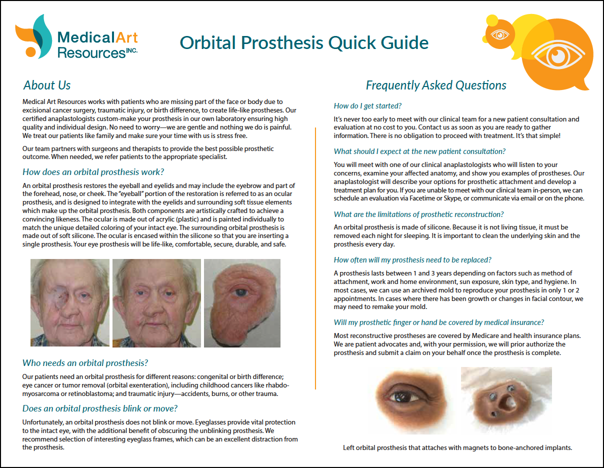 Orbital Prosthesis Quick Guide