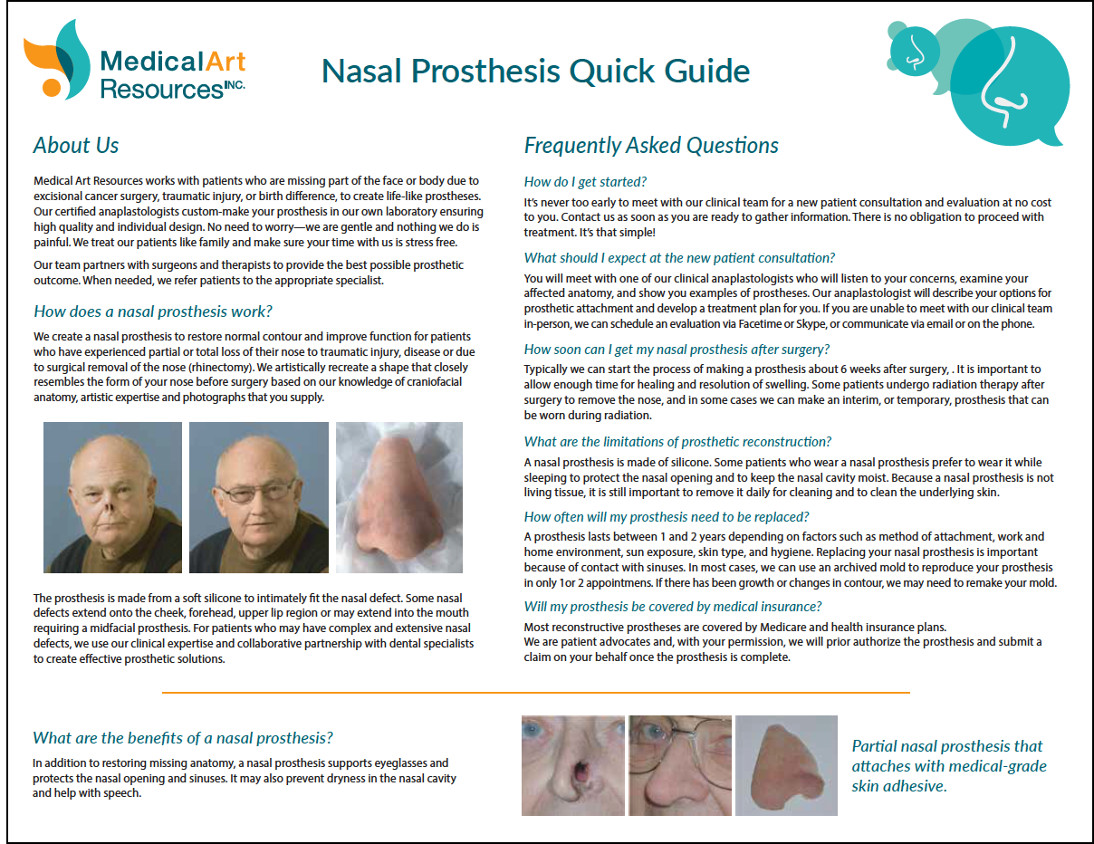 Nasal Prosthesis Quick Guide